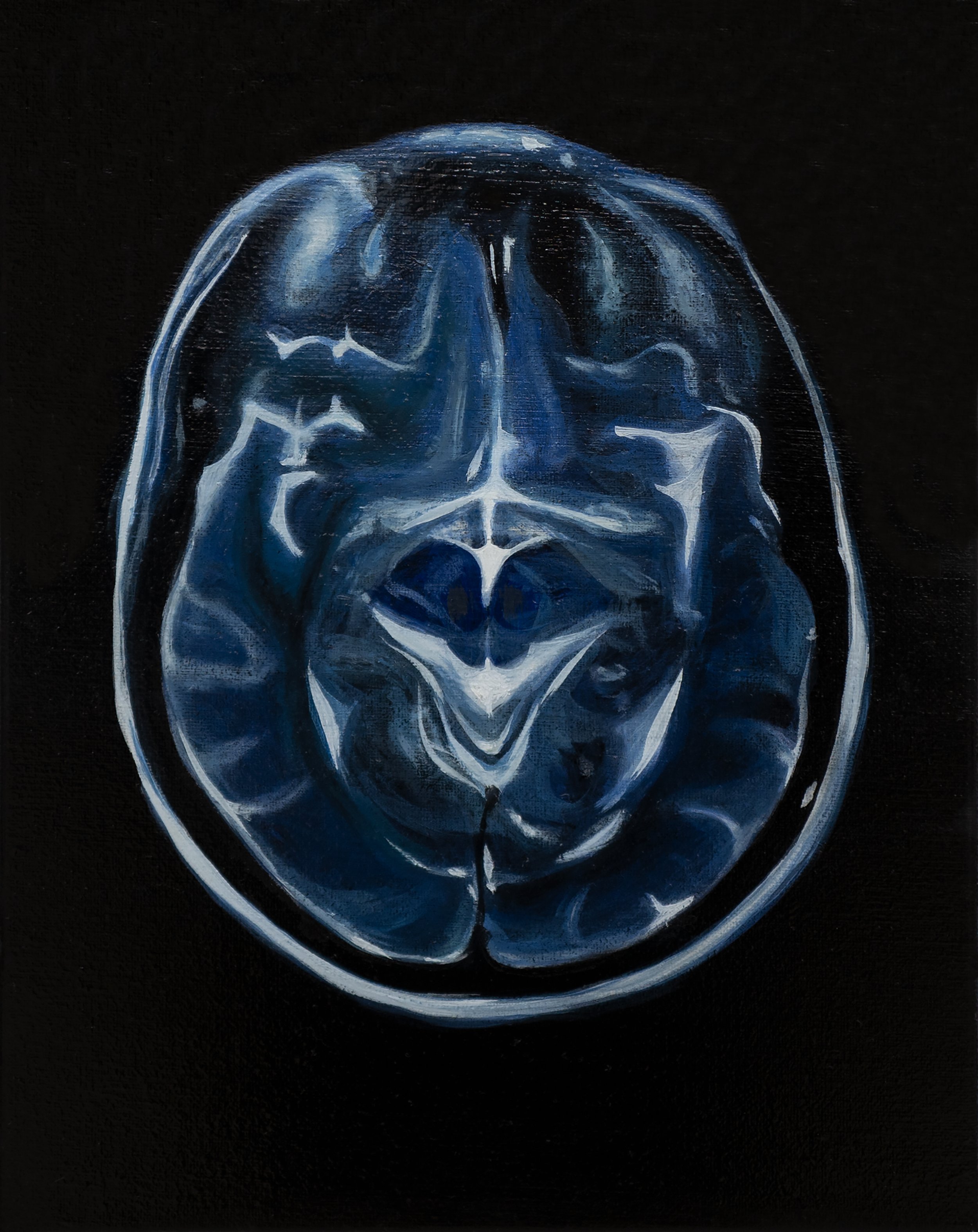 Tan Mu, MRI, 2021. Detail of the cerebral cortex.